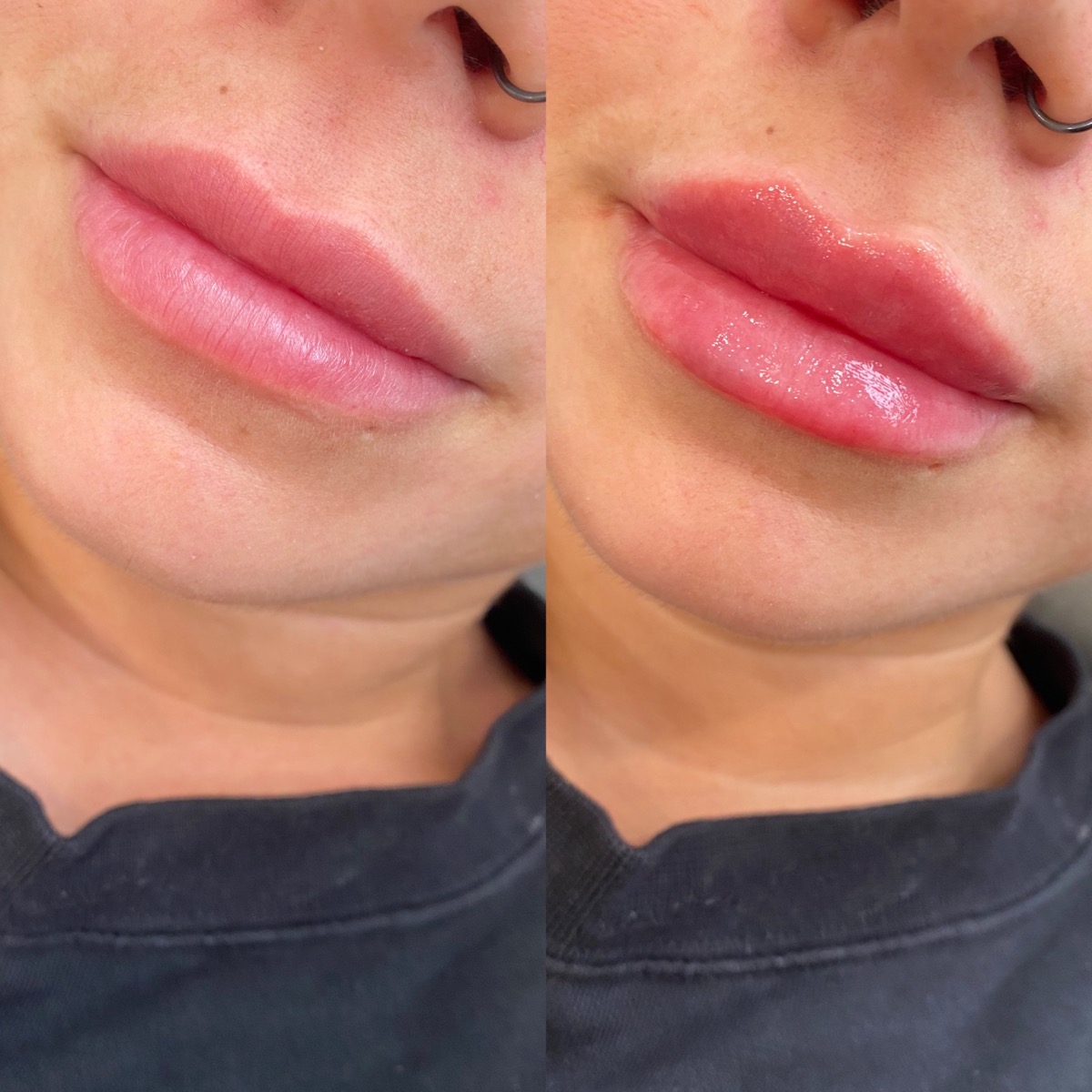 Injectables client results 6
